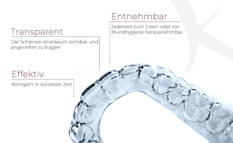 Aligner bei dr. Rezaie